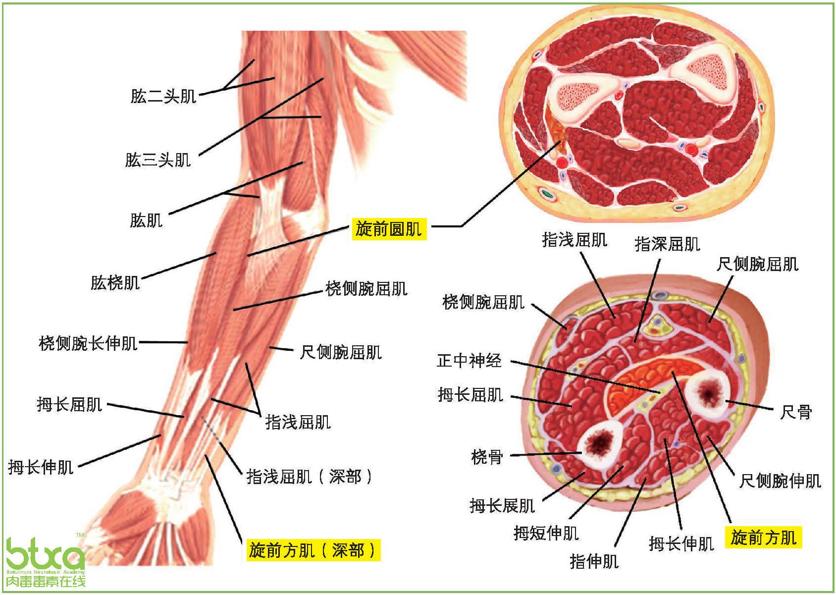 二、上運動神經(jīng)元損傷繼發(fā)上肢痙攣